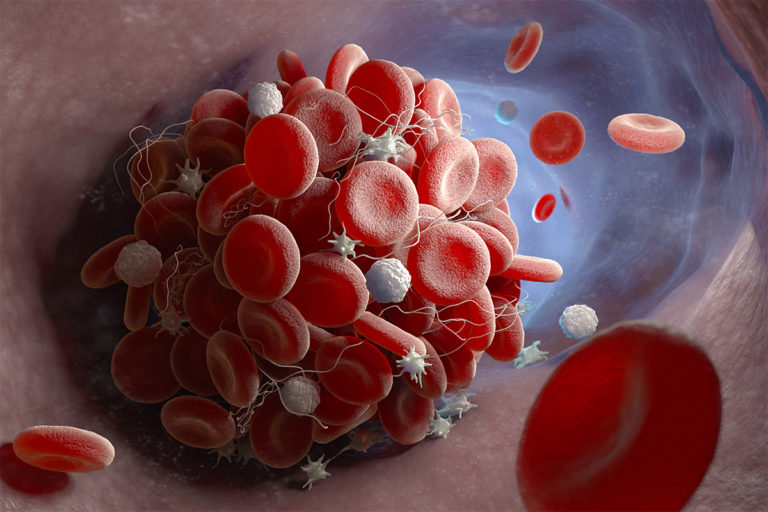 Bleeding and Clotting